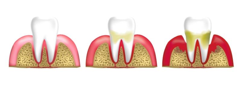Bild: pongpongching – stock.adobe.com