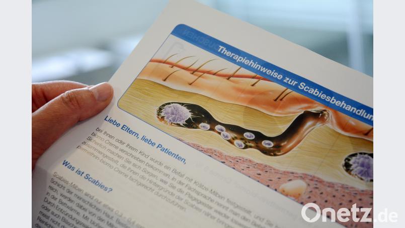 Hautärzte und manche Apotheken halten Infoblätter zur Therapie von Krätze bereit. Die Milbe bohrt Kanäle unter die Haut. Ihre Absonderungen lösen juckende Hautausschläge aus. Schönberger