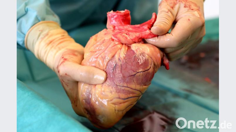 Ein Transplantationsmediziner hält das Herz eines Verstorbenen in den Händen, das kurz zuvor entnommen wurde. Dem Organ werden später die Herzklappen für Gewebespenden entnommen. Bild: Bernd Wüstneck/dpa