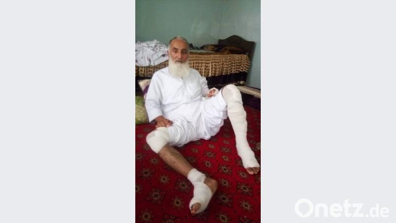 Der Torwächter der Schule, Ahmad, wurde an beiden Beinen verletzt. Er dürfte aber nach Einschätzung von Reinhard Erös bald wieder arbeitsfähig sein. 	Bild: Kinderhilfe Afghanistan Bild: Kinderhilfe Afghanistan