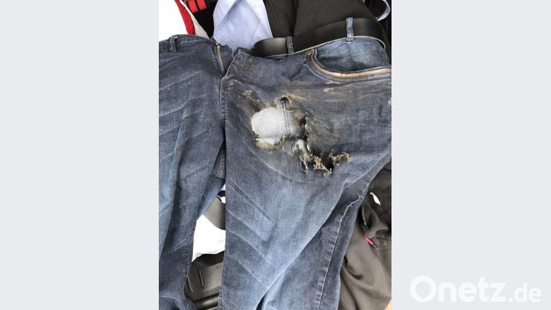 Die Explosion riss ein Loch in die Jeans. Bild: Polizei