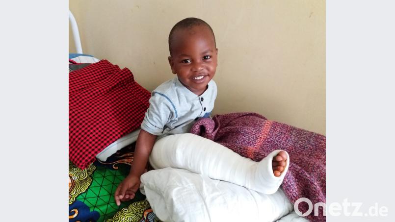 Christian nach Korrektur eines X-Beines. Bild: exb