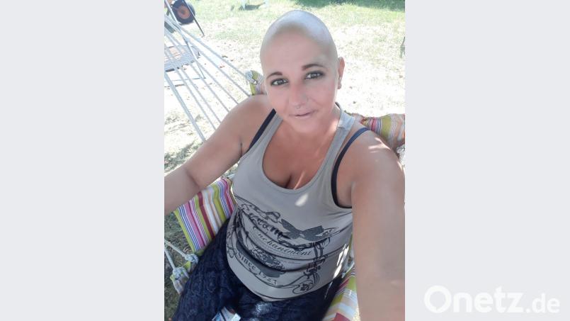 Ein Selfie vom Sommer 2018. Theresa Baudler hat sich gerade den Kopf frisch rasiert. Mit ihrer Erkrankung geht sie weiterhin offen um. Bild: exb