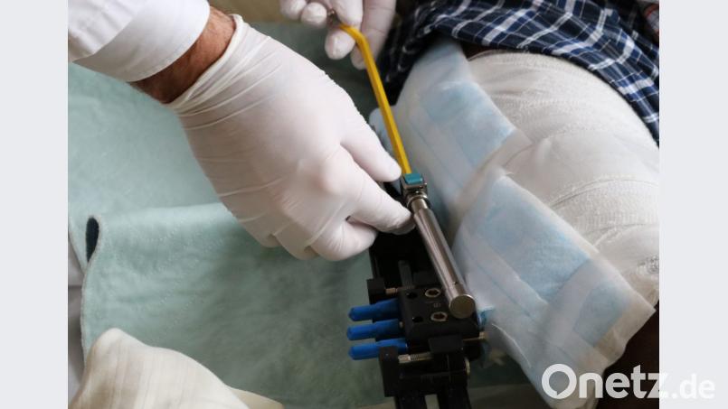 Mit einem Distraktionsfixateur kann das Bein sukzessive verlängert und in allen Ebenen korrigiert werden. Bild: exb