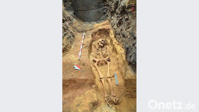 Dieser junge Mann starb um das Jahr 1300 herum. Die Todesursache dürfte in seinem massiven Kariesbefall zu suchen sein. Bild: exb