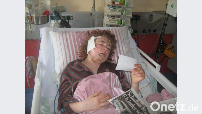 Schwer verletzt liegt Sophia Brüderer vor elf Jahren im Krankenhaus. Sie überlebt damals einen schlimmen Schulbusunfall bei Friedersreuth. Nun erzählt die heute 24-Jährige ihre Geschichte. Bild: exb/ Claudia Brüderer