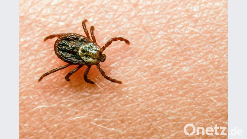 Eine Zecke krabbelt über den Arm einer Person auf der Suche nach der perfekten Einstichstelle. Bild: Patrick Pleul