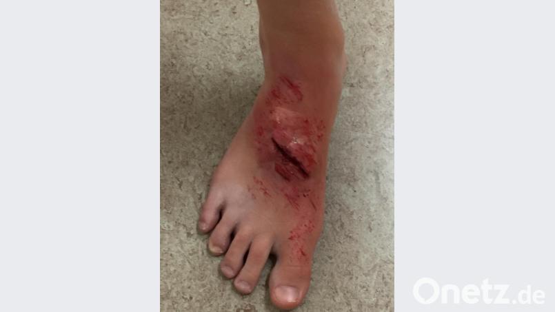 Mit täuschend echt aussehenden Verletzungen und Notfällen haben es die jungen Sanitäter bei der Prüfung zu tun. Bild: exb