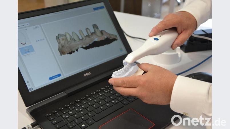 Dentaltechnik 4.0: Mit so einem Lesestift arbeiten bereits erste Zahntechniker und Ärzte. Das Gerät scannt Zahnstrukturen (wie auf dem Bild) von einem Modell ab oder direkt im Mund des Patienten. Mit den Daten kann der Zahnersatz ohne Umwege und exakt erstellt werden. Bild: Reiner Wittmann