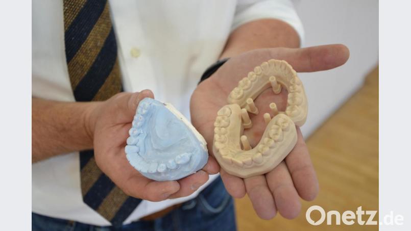 Die Zeiten ändern sich und mit ihnen das Handwerk: Links ein manuell gefertigtes Gips-Modell, rechts ein Muster aus dem 3-D-Drucker. Bild: Reiner Wittmann