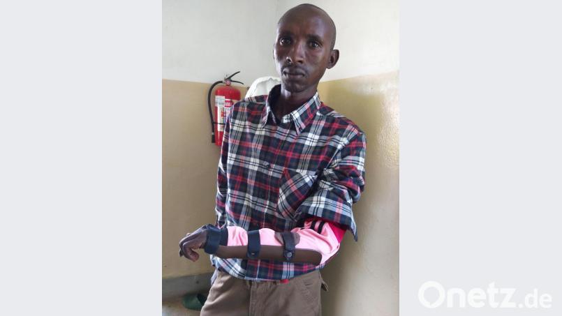 Der junge Massai Joel wurde von einem Löwen schwer verletzt. Jetzt kann er seine Hand wieder benutzen und vielleicht auch weiterstudieren. Bild: exb