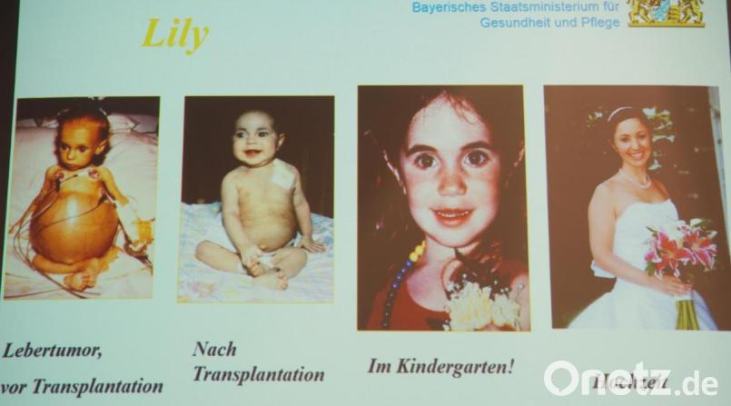 Ein Beispiel einer Organtransplantierten zeigt die Informationskampagne des Bayrischen Gesundheitsministeriums. Bild: Bühner