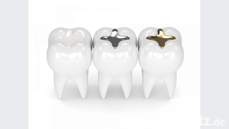 Verschiedene Zahnfüllungen Bild: ©pictoores - stock.adobe.com