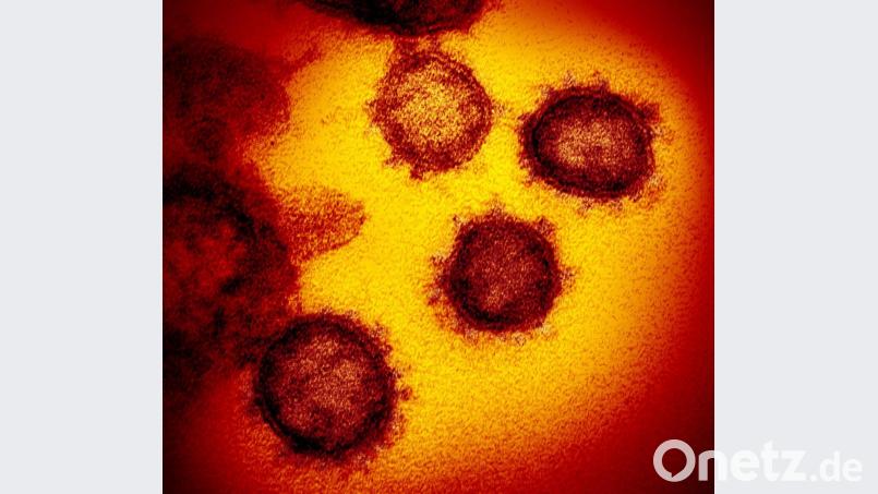Das neuartige Coronavirus (SARS-CoV-2). Die Probe wurde von einem Patienten in den USA isoliert. Bild: NIAID-RML/AP/dpa