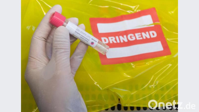 Eine Probe wird für einen Coronatest vorbereitet. Das Ergebnis soll so schnell wie möglich vorliegen. Bild: Robert Michael/dpa
