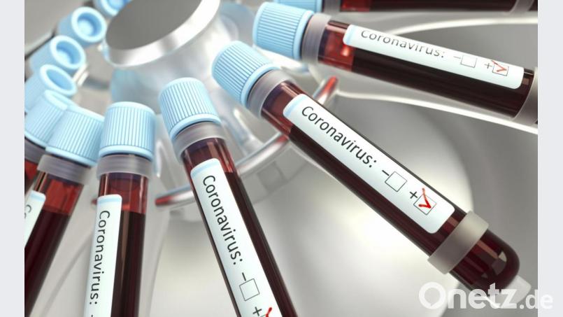 Wer wird auf das Virus getestet? Bild: KTSDESIGN/SCIENCE PHOTO LIBRARY via GettyImages