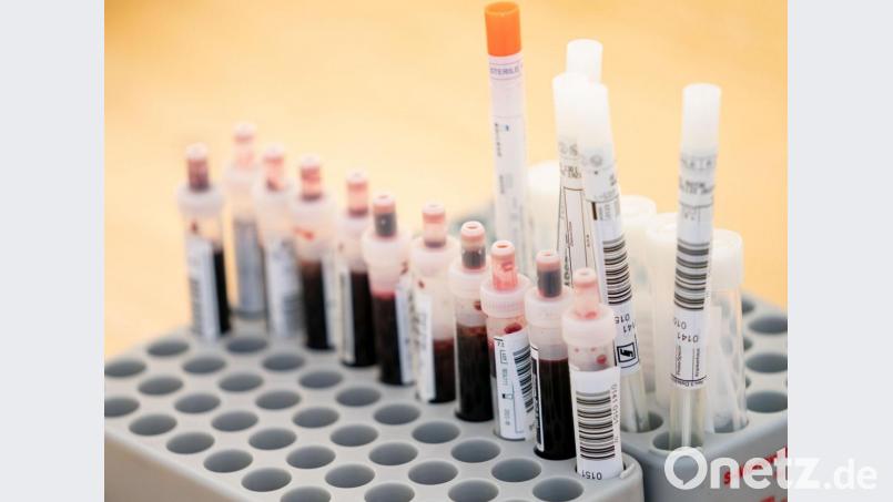 Die Labore sind mit den Tests auf das Coronavirus stark ausgelastet. Symbolbild: Kay Nietfeld/dpa