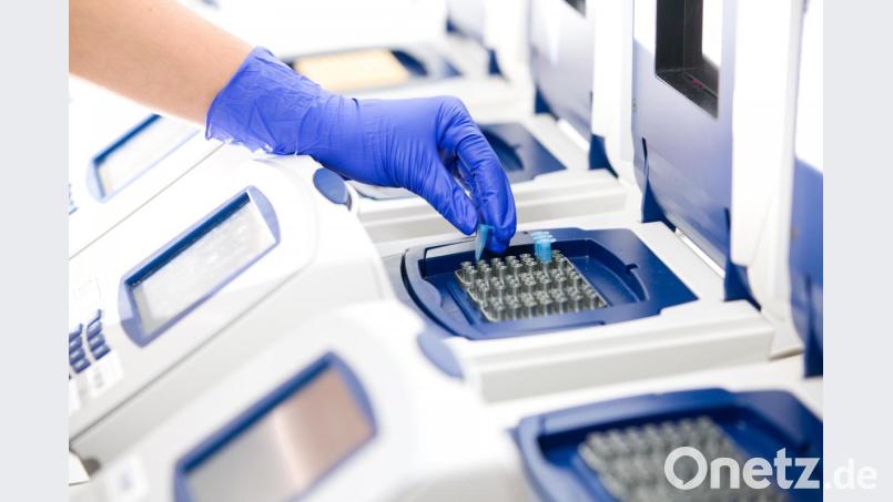 Gerade mal zwei neue positive Tests erfasst die Statistik des Landesamtes für Gesundheit. Bild: Synlab