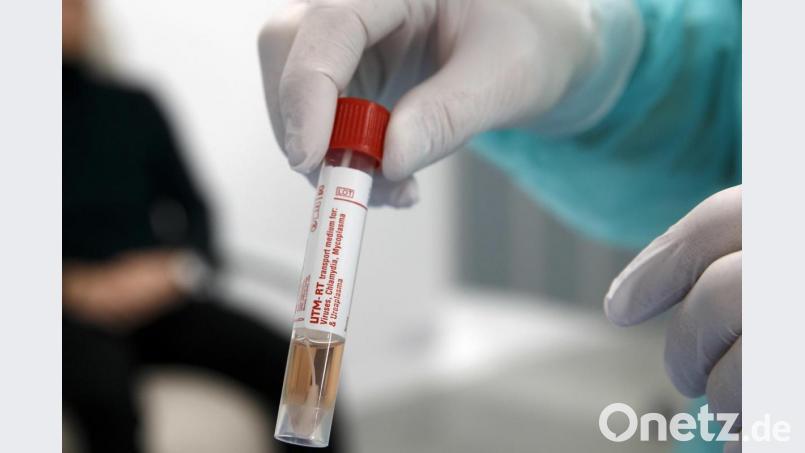 Julien Salamun, Arzt, hat im Universitätsspital Genf eine Probe einer Person, die im Verdacht steht, mit dem Coronavirus Covid-19 infiziert zu sein, in der Hand. Symbolbild: Salvatore Di Nolfi