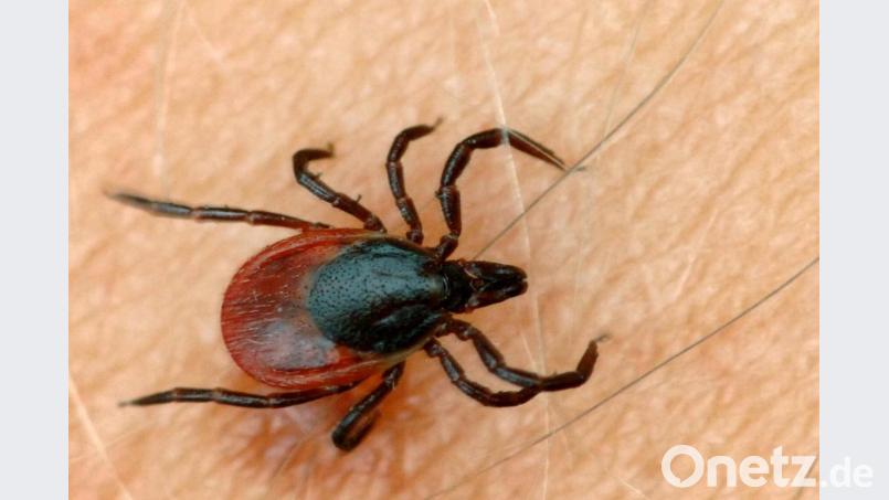 Eine Zecke krabbelt auf der Haut eines Menschen. Bild: Patrick Pleul/dpa