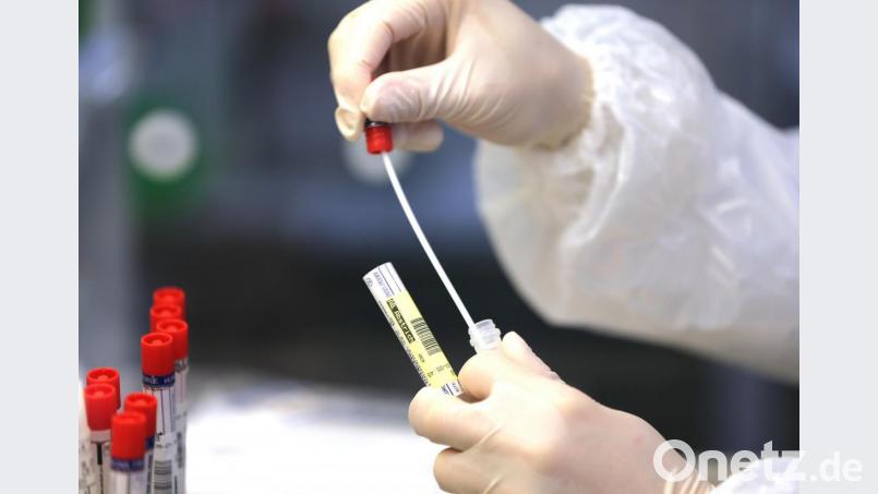 Ein Wattestäbchen eines Corona-Abstriches wird in einem Labor bearbeitet. Symbolbild: Oliver Berg/dpa