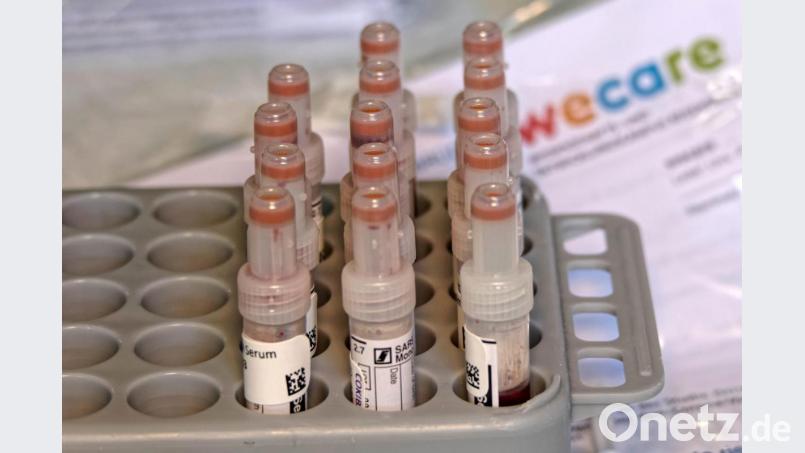 In diesen Ampullen wird das Blut für den Test aufbewahrt. Bild: tr