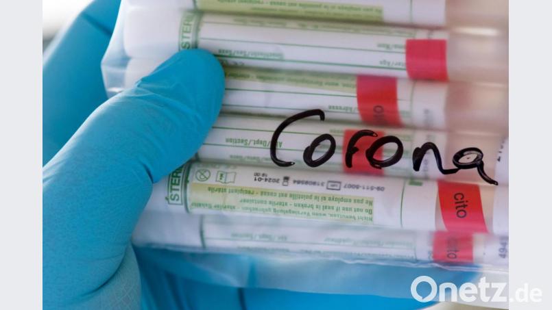 Proben für Corona-Tests werden untersucht. Symbolbild: Hendrik Schmidt/dpa