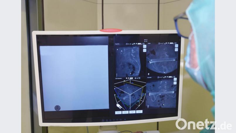 Der neue Bildwandler ermöglicht es, Gelenke aus verschiedenen Perspektiven zu sehen. Bild: Klinikum/Dietl/exb