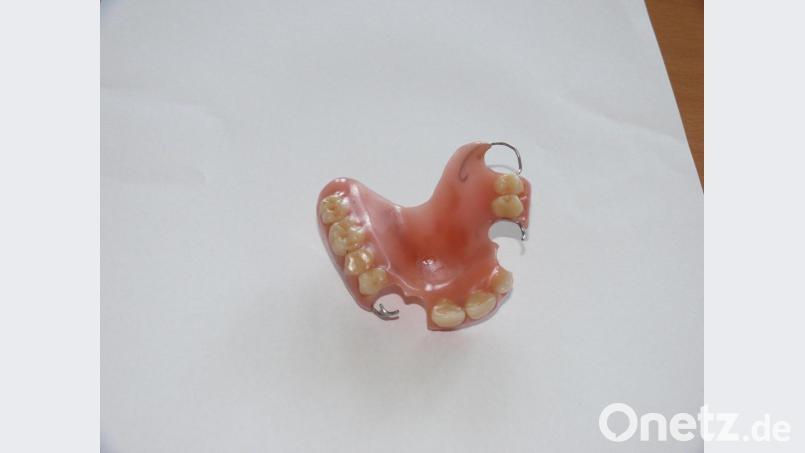 Dieses Gebiss blieb am Dienstagvormittag am Bahnhof liegen. Der Eigentümer kann es beim Fundamt der Stadt Amberg abholen. Bild: exb