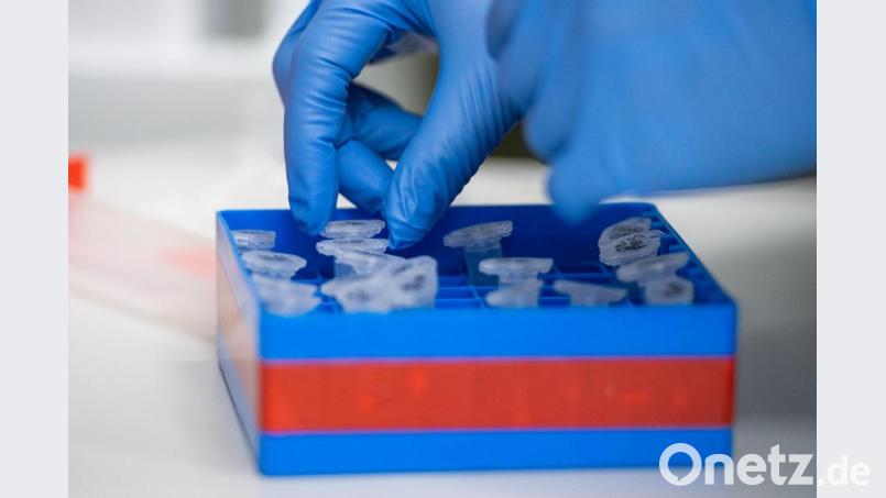 Ein Massentest soll Gewissheit bringen in Garmisch. Bild: Christophe Gateau