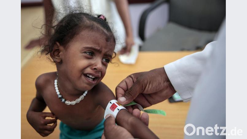 Ein Arzt misst den Armumfang eines unterernährten Mädchens im Aslam Health Center im Jemen. Die Vereinten Nationen bezeichnen den Krieg im Jemen als die größte humanitäre Katastrophe der Gegenwart. Bild:  Hani Mohammed