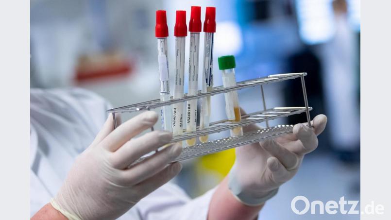 Eine Laborantin bereitet Corona-Proben für die weitere Analyse vor. Foto: Sven Hoppe/dpa/Symbolbild Bild: Sven Hoppe