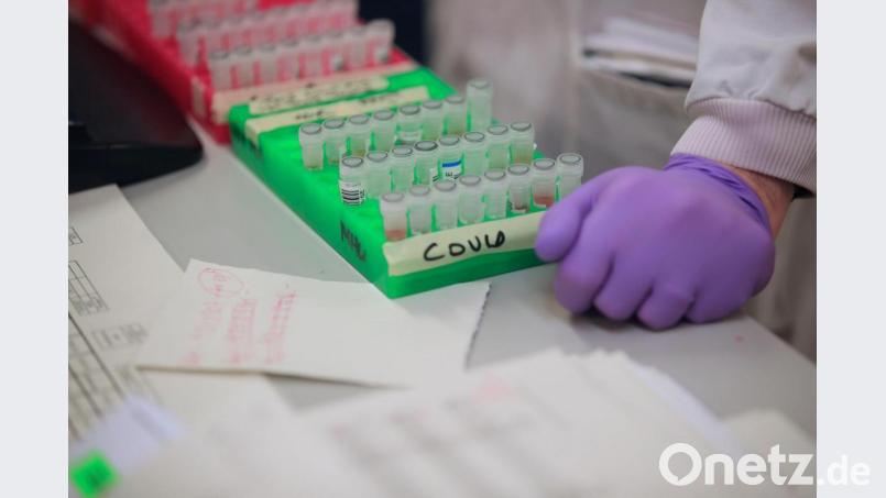 Die Kapazitäten in den Laboren geraten langsam an ihre Grenzen: Auch im Stadtgebiet Amberg und im Landkreis Amberg-Sulzbach gibt es immer mehr Menschen, die positiv auf das Coronavirus getestet werden. Bild: Danny Lawson/PA Wire/picture alliance/dpa