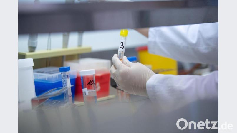 Eine Ärztin zeigt in einem Labor einen Test für das Coronavirus. Symbolbild: Sebastian Gollnow/dpa