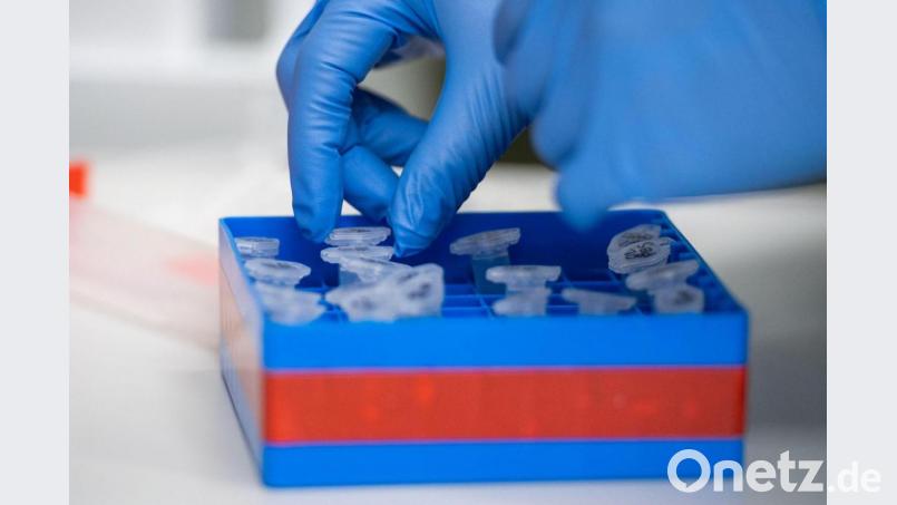 Eine Laborantin sortiert Proben. Symbolbild: Christophe Gateau/dpa