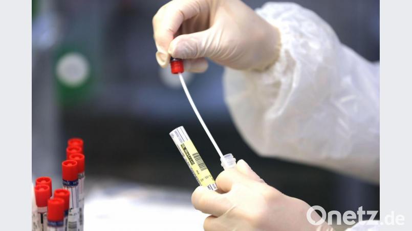 Ein Laborant untersucht das Wattestäbchen eines Corona-Abstrichs. Bild: Oliver Berg
