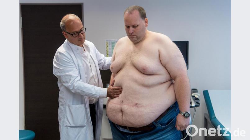 Vier Wochen, nachdem ihm die Chirurgen einen „Schlauchmagen“ geformt haben, wird ein Patient untersucht. Dabei zeugen kleine Narben auf dem Bauch des Patienten von der Operation. Symbolbild: Boris Roessler/dpa