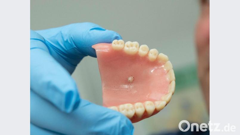 Weil er viel Ärger mit seinen dritten Zähnen hatte, ging ein Rentner aus dem Landkreis Wunsiedel vor Gericht. Symbolbild: Swen Pförtner/dpa