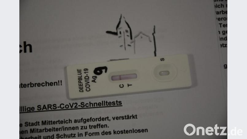 Bei allen Probanden zeigte der Coronatest negativ an. Bild: jr
