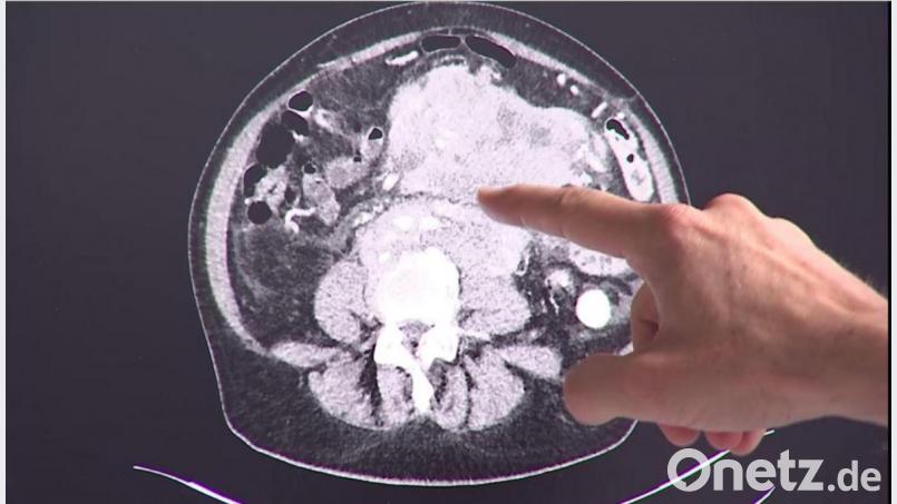 Darmvorsorge ist auch zu Coronazeiten wichtig, betonen die Ärzte des Klinikums Amberg. Bild: Klinikum/Dietl