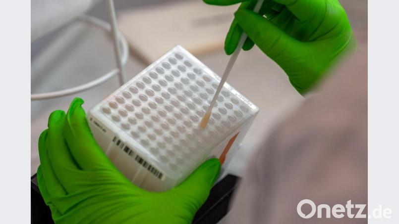 Eine Labormitarbeiterin arbeitet an der Einsortierung der medizinischen Wattestäbchen mit Zellen der Wangenschleimhaut für den Typisierungsprozess der DNA. Archivbild: Robert Michael