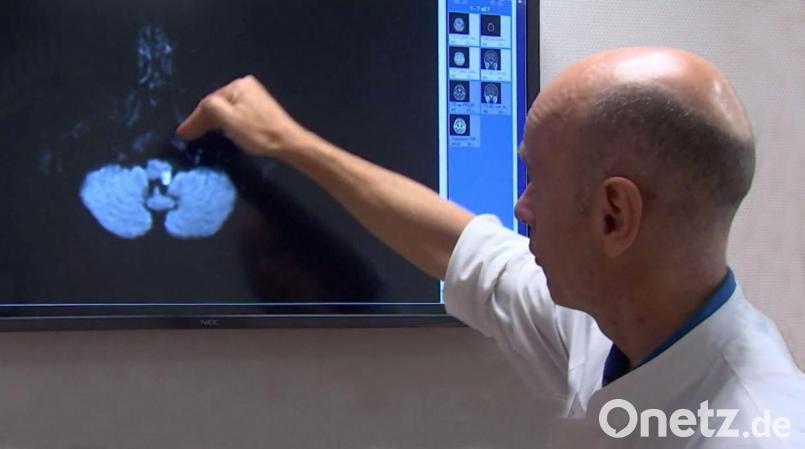 Dr. Frank Huber sieht sich das Bild eines Schlaganfalls an. Beim Ratgeber Gesundheit digital des Klinikums informierte der Chefarzt der Klinik für Neurologie mit seiner Kollegin Dr. Michaela Nagel über Schlaganfälle. Bild: Klinikum/Dietl/exb