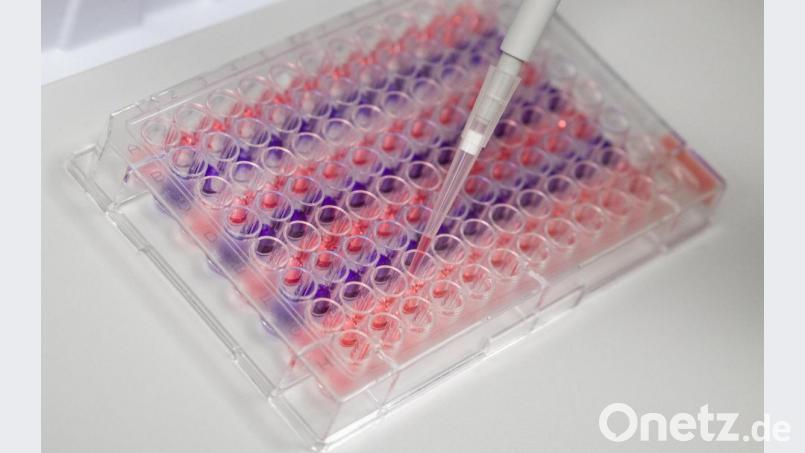 Ein Laborant arbeitet mit einer Pipette im Institut für Virologie an der Charité Berlin Mitte, in dem Untersuchungen zum Coronavirus laufen. Archivbild: Christophe Gateau/dpa