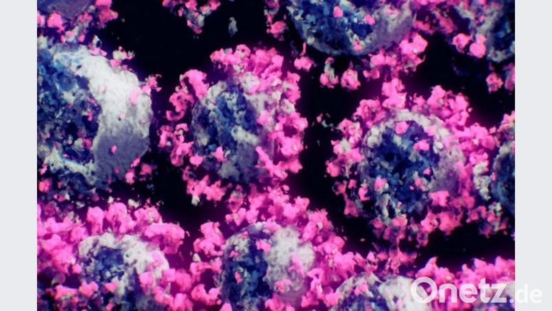 Eine Aufnahme von Forschern des TU Wien-Spin-off Nanographics zeigt Coronaviren. Bild: Peter Mindek/Nanographics/apa/dpa