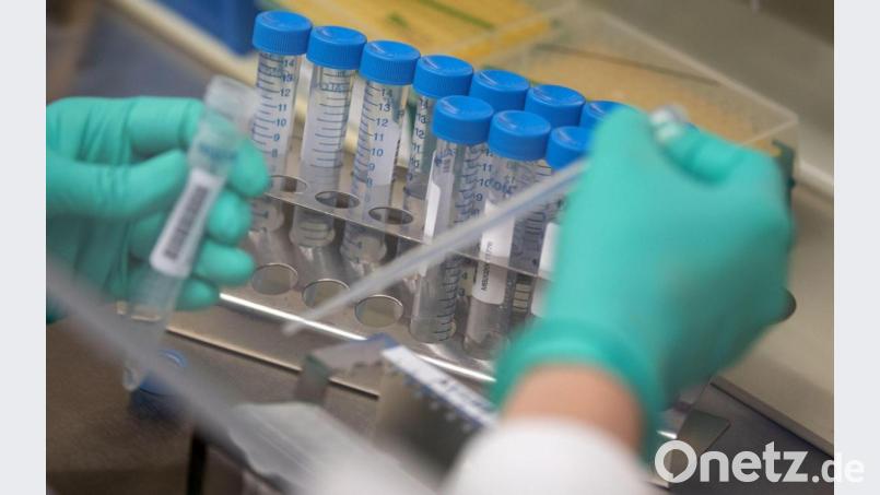 Eine Mitarbeiterin des Landesgesundheitsamts Baden-Württemberg pipettiert Coronaproben. Für Amberg und Amberg-Sulzbach weist das Robert-Koch-Institut für Montag, 22. Juni, keine neuen Infektionen mit dem Virus aus. Symbolbild: Marijan Murat/dpa