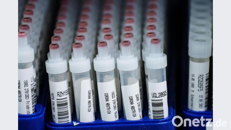 Tests auf Corona mag es auch in Weiden und im Landkreis Neustadt gegeben haben. Aber keiner war mit Blick auf die RKI-Zahlen am Donnerstag positiv. Symbolbild: Andreas Arnold/dpa