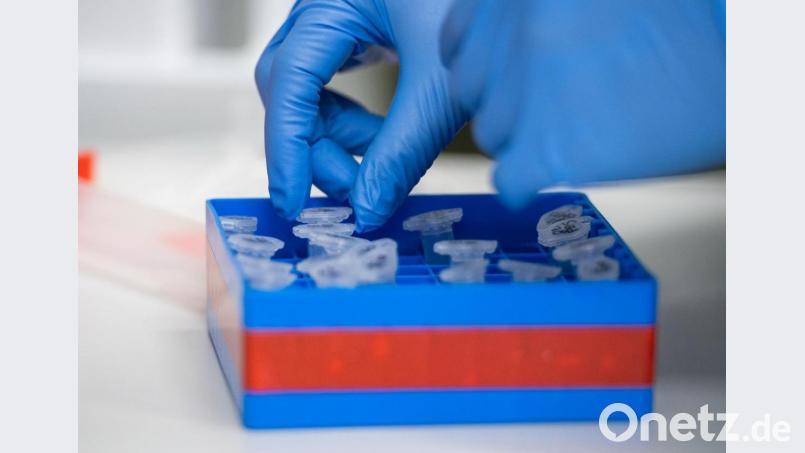 Eine Laborantin sortiert Proben im Institut für Virologie an der Charite Berlin Mitte in dem Untersuchungen zum Coronavirus laufen. Symbolbild: Christophe Gateau/dpa