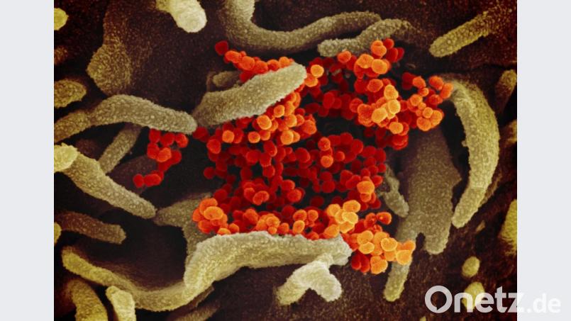 Eine elektronenmikroskopische Aufnahme des U.S. National Institute of Health zeigt das Coronavirus (orange), das aus der Oberfläche von im Labor kultivierten Zellen (grau) austritt. Die Probe wurde von einem Patienten in den USA isoliert. Foto: NIAID-RML/dpa Symbolbild: NIAID-RML/dpa