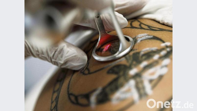 Wird ein Tattoo per Laser entfernt, muss die Behandlung in der Regel mehrmals wiederholt werden. Zwischen den Sitzungen sollten dann vier bis sechs Wochen liegen. Symbolbild:  Carsten Koall/dpa