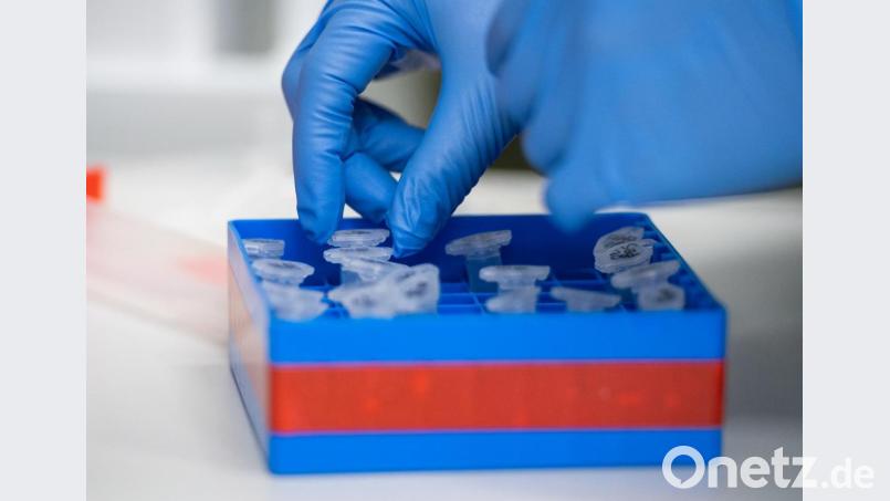 Eine Laborantin sortiert im Institut für Virologie an der Charité Berlin Mitte, in dem Untersuchungen zum Coronavirus laufen, Proben. Symbolbild: Christophe Gateau